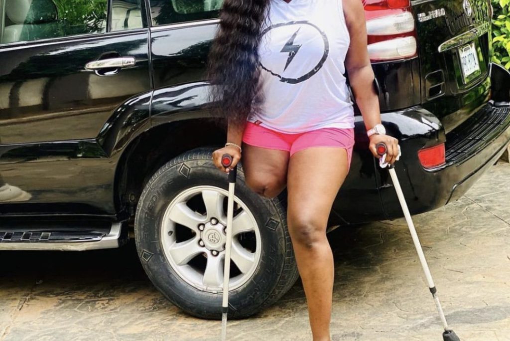 Amputee Nollywood actress and dancer Doris Samuel Akonanya has stated that many men go into relationships with her out of pity